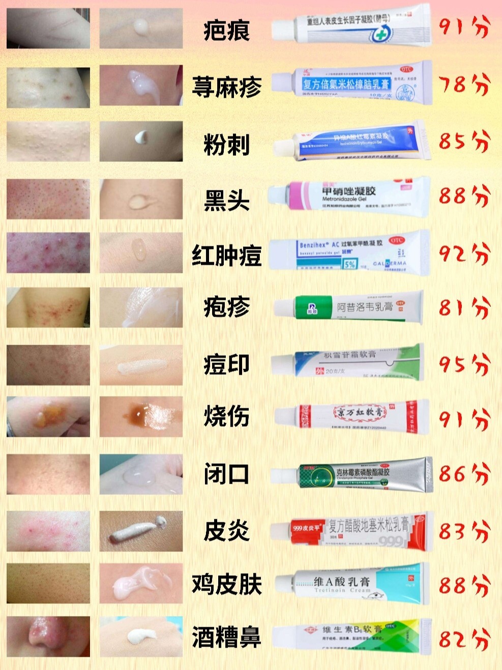 78荨麻疹——复方倍氯米松樟脑乳膏 78粉刺——异维a酸红霉素凝胶