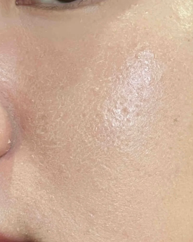 为什么化妆的时候脸上起皮