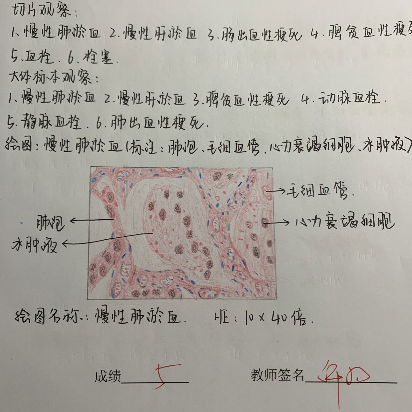 肺淤血绘图图片