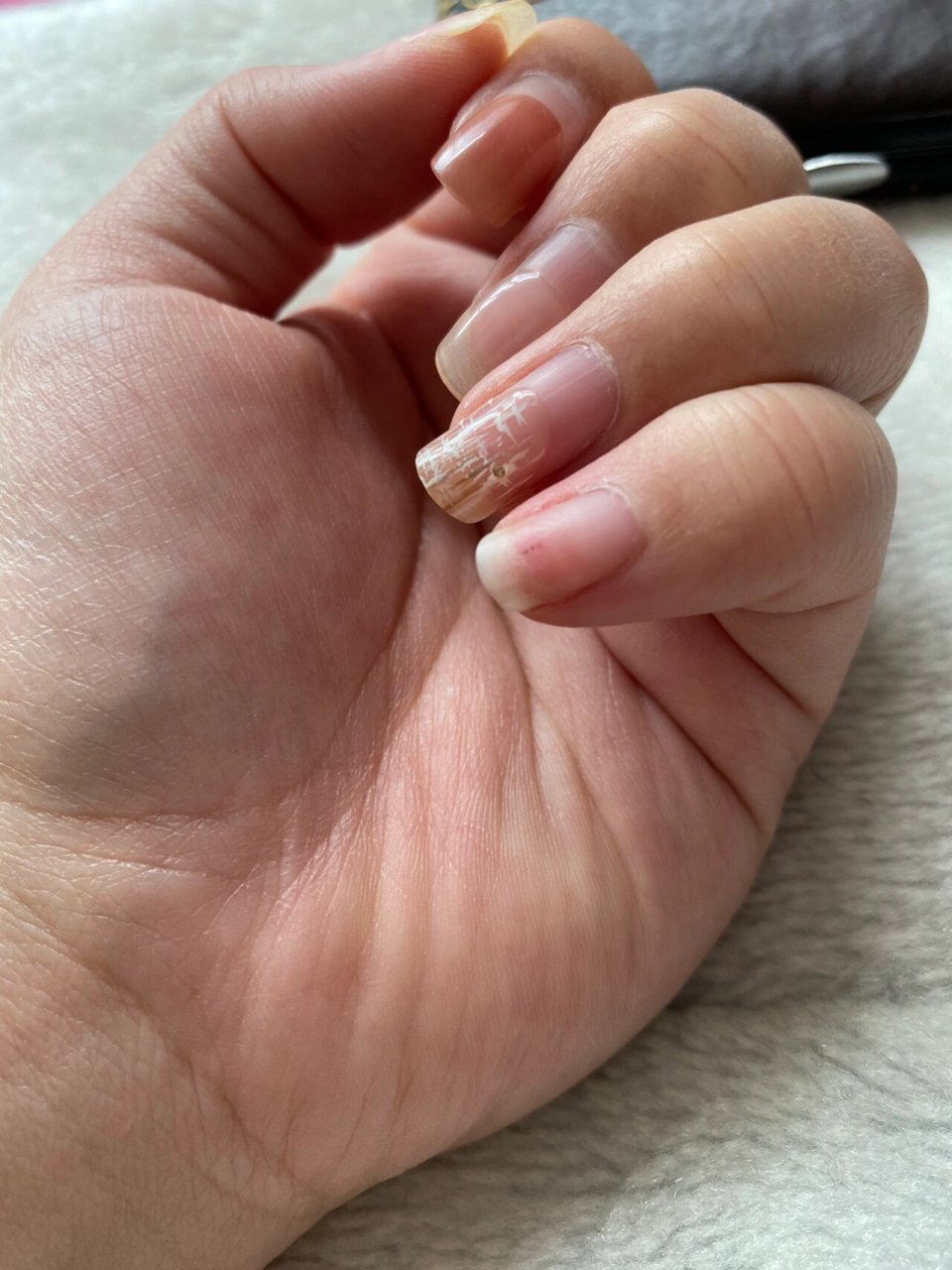 现在指甲特别软,没几天之后发现空甲了,这个养养会好吗?需要管它不?