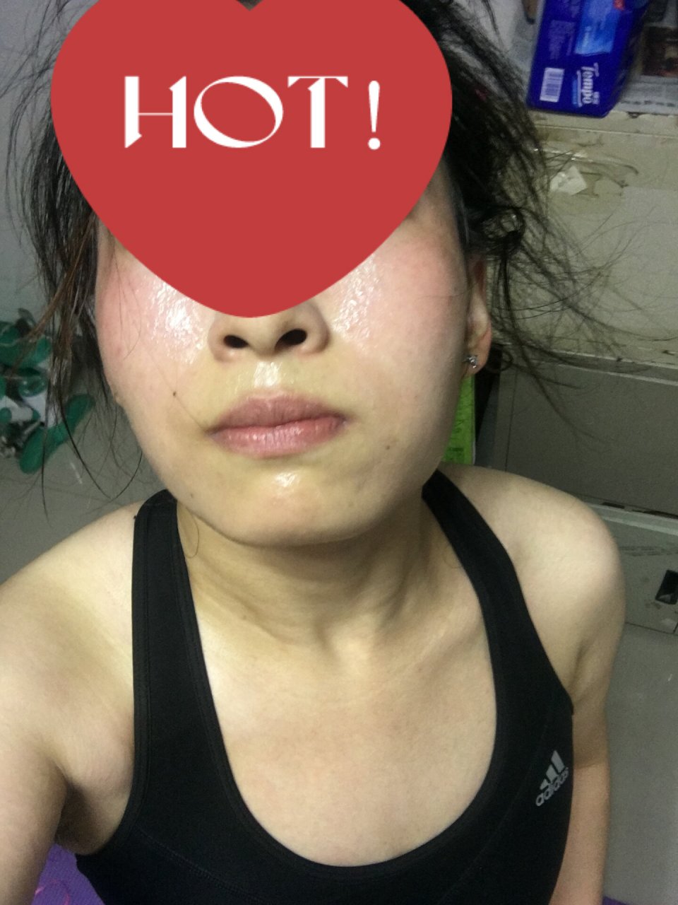 嘴巴周围黄气很重 有没有嘴巴周围黄气很重的宝呢,特别是运动出完汗