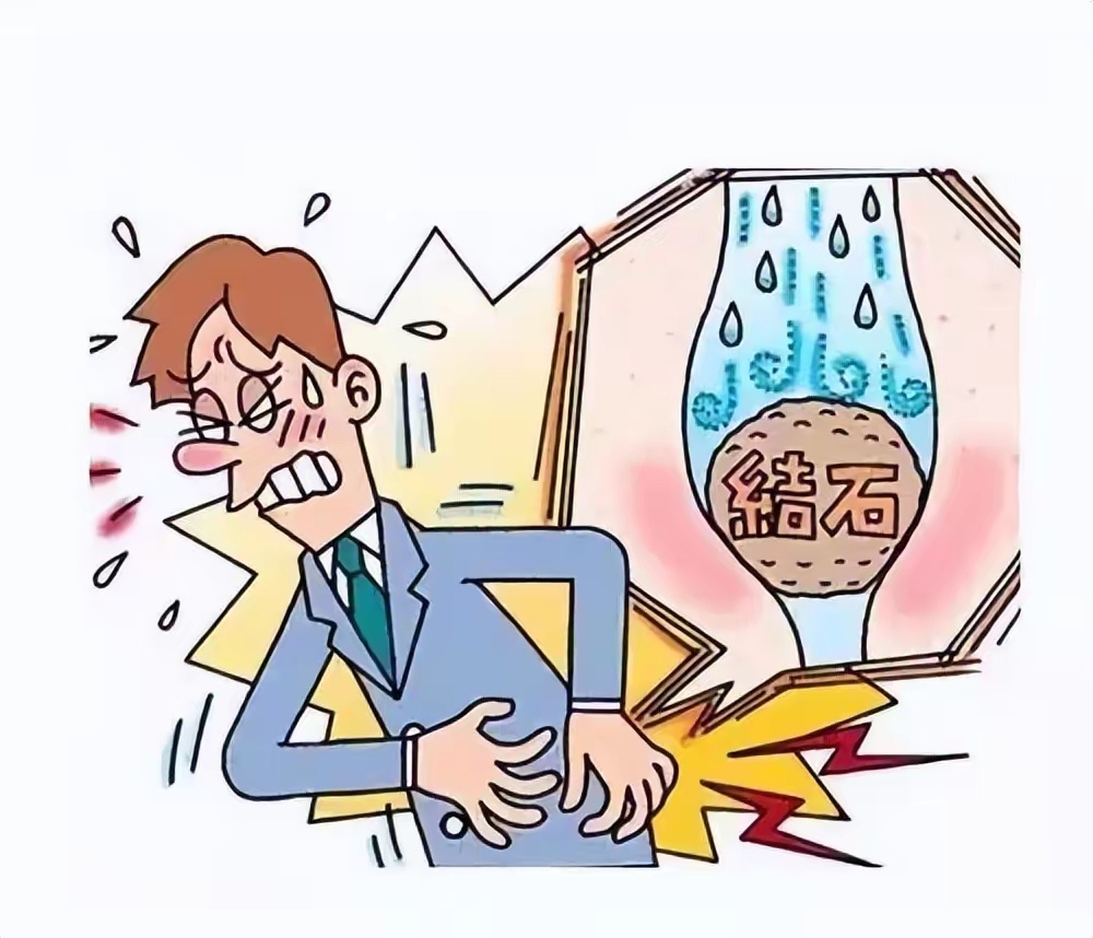 剧烈运动跳掉肾结石能有多疼#想象一下,前一刻还沉浸在由肾结石引发
