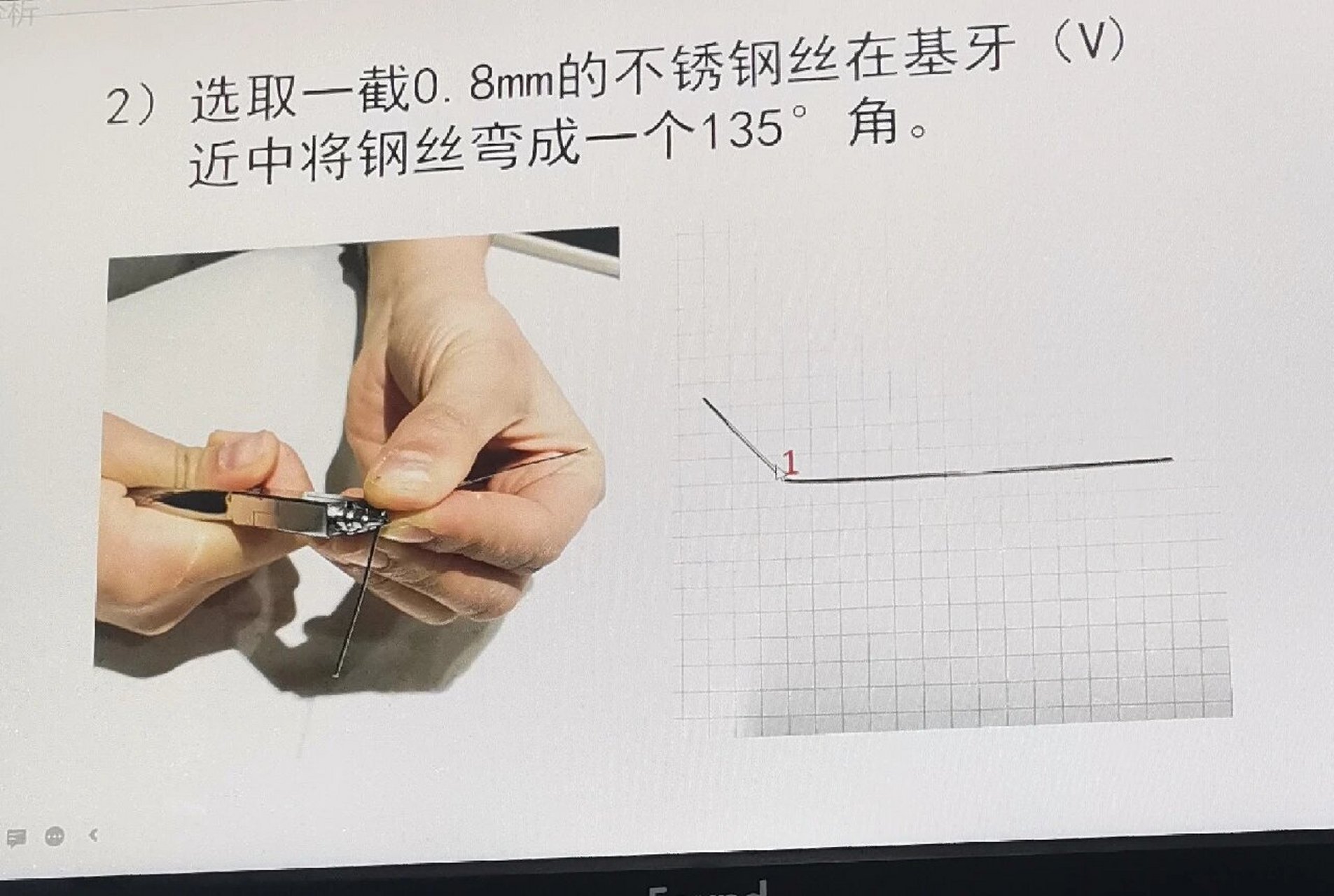 钢丝保持器戴法演示图图片