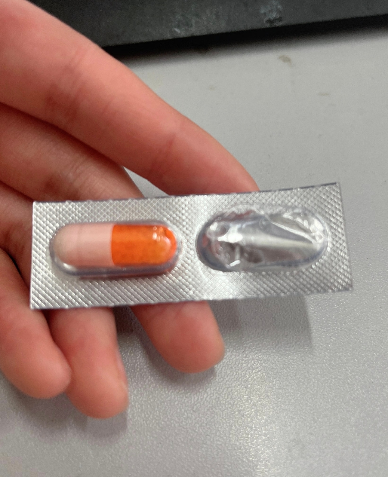 髋关节钙化是指髋关节组织中出现钙质沉积的情况
