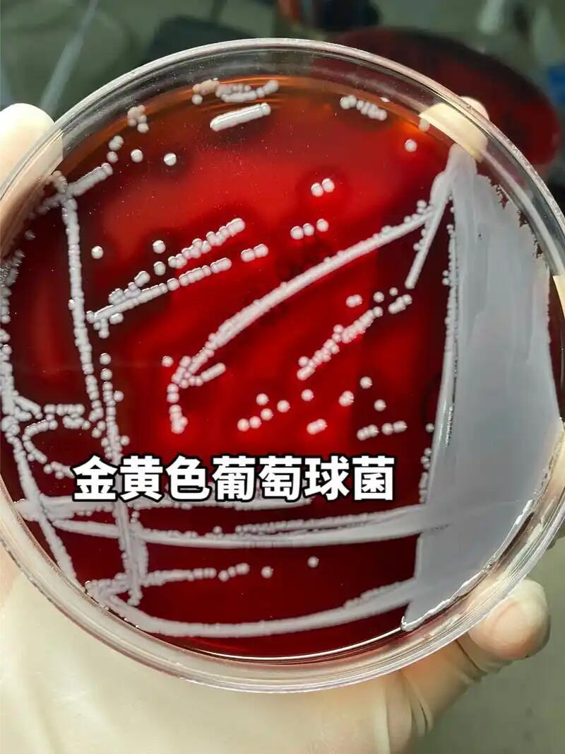 金黄色葡萄球菌落在不同培养基上的颜色变化