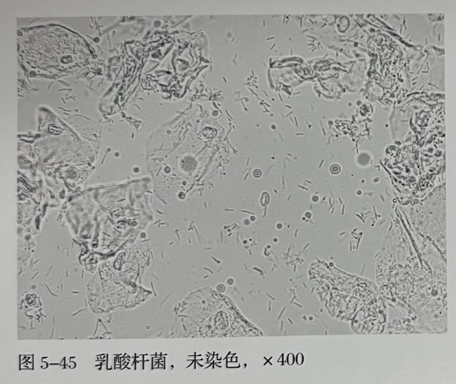 白带显微镜图片