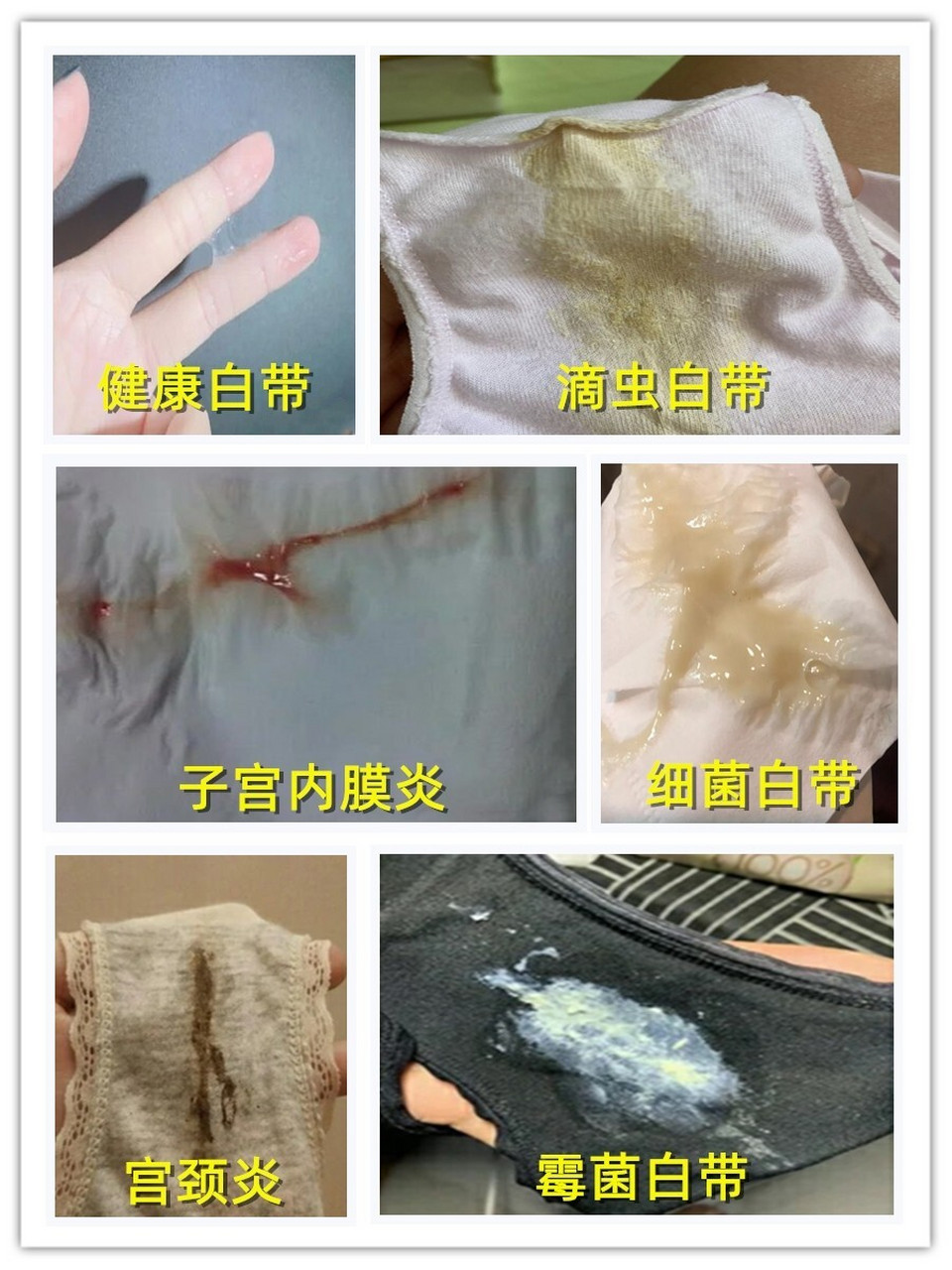 白带不正常很久了,用了它们终于解决了.