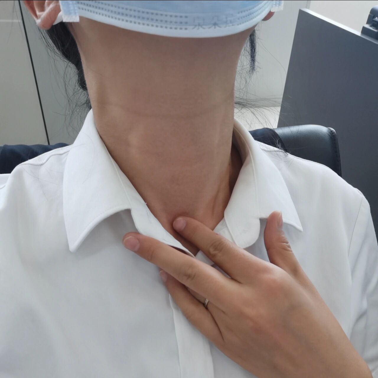 甲亢患者大脖子