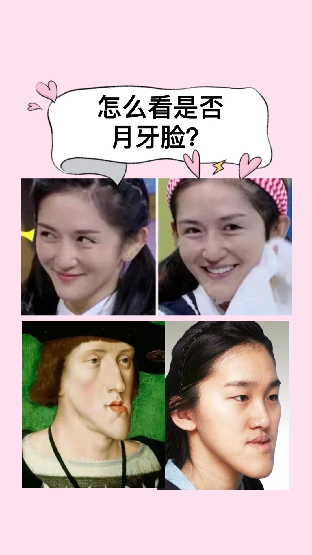 重度地包天俗称月亮脸95 99月亮脸"的特征是:两边翘,中间凹,面
