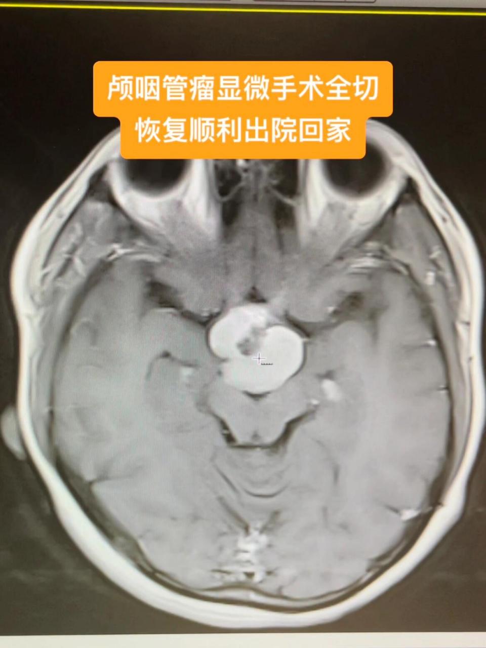 鞍区麻木图片