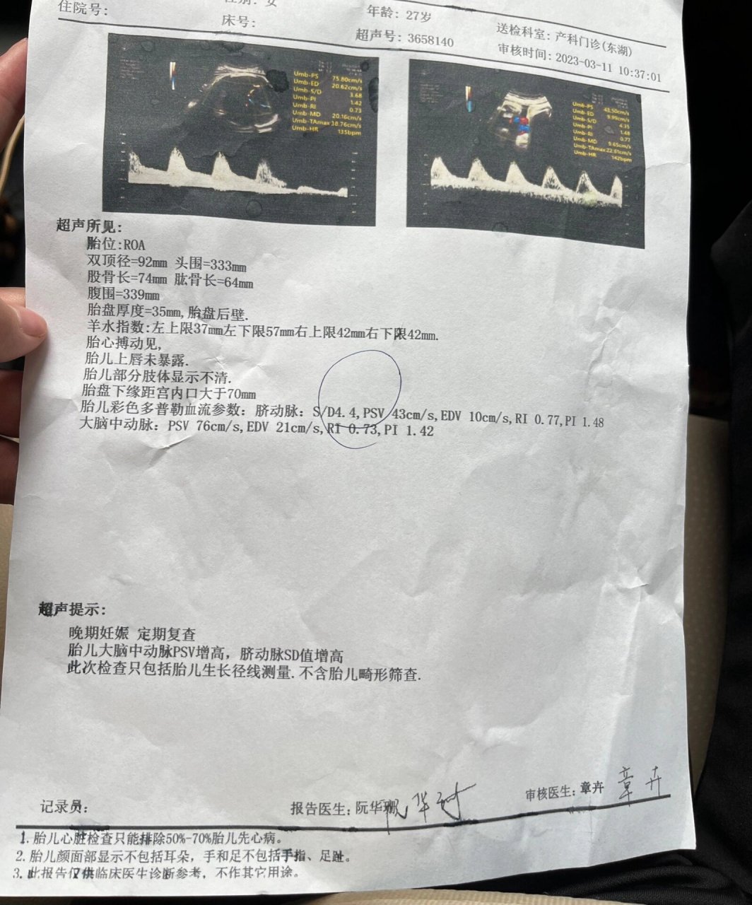 15常规产检b超发现脐动脉sd比值有3.
