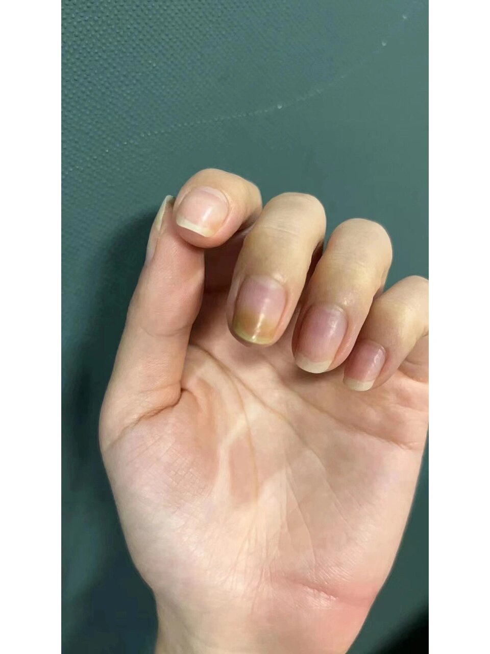 这就是绿脓杆菌,它是非常小的细菌04 喜欢潮湿阴暗的环境 在水中