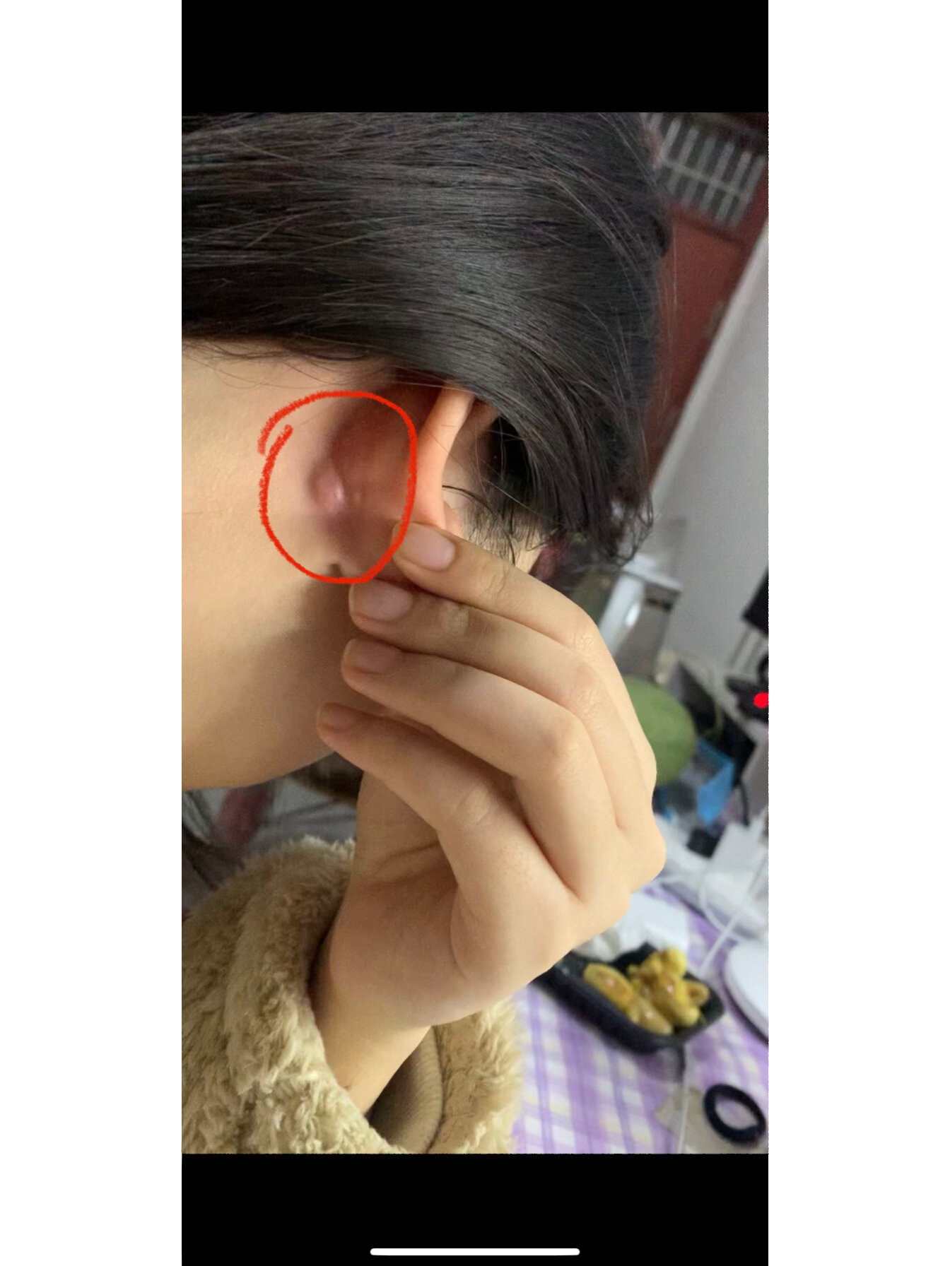 求助🆘|耳朵后面长个包