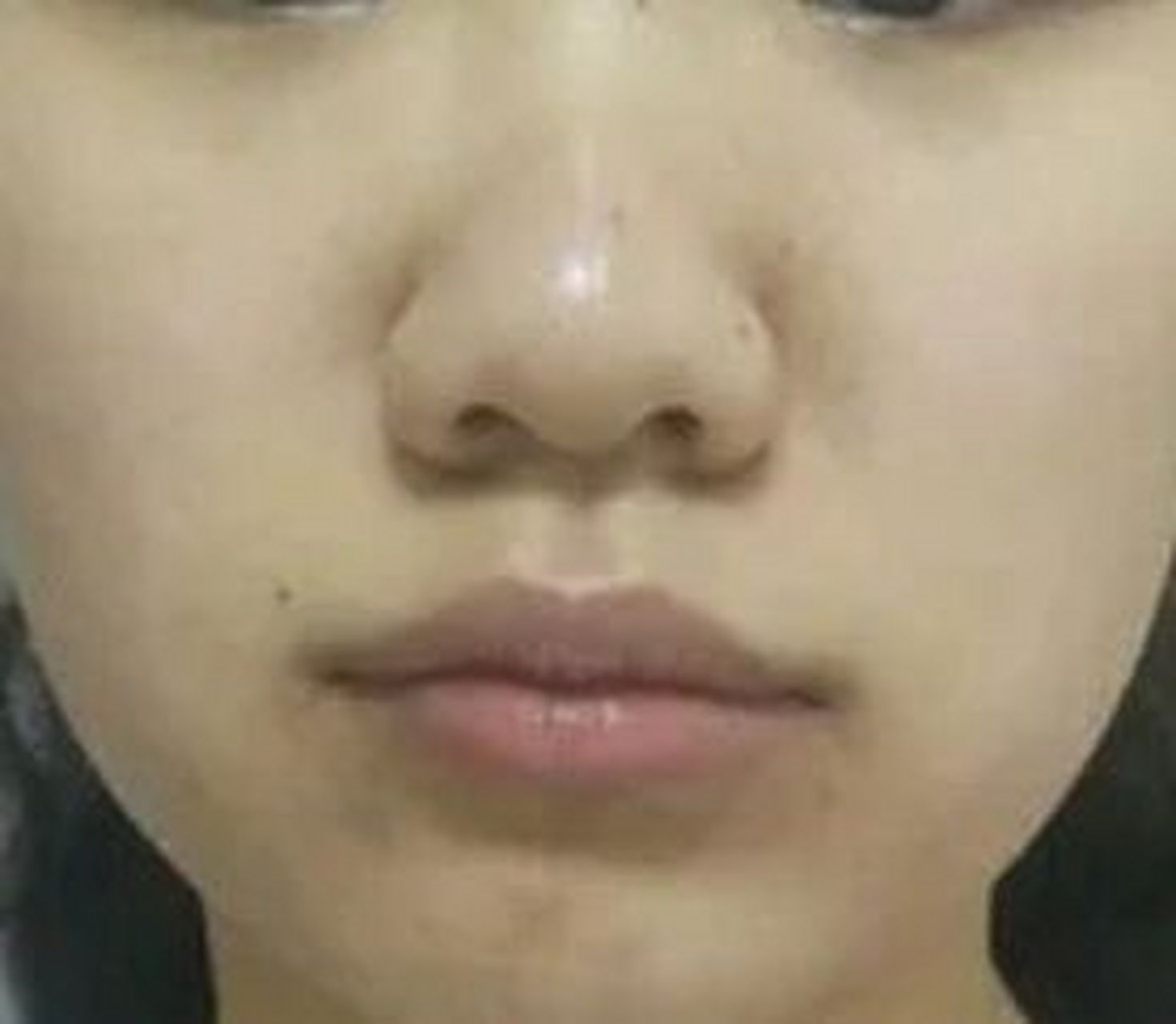 蒜头鼻即山根低平,鼻梁几乎是一条线,而准头大而圆的鼻子