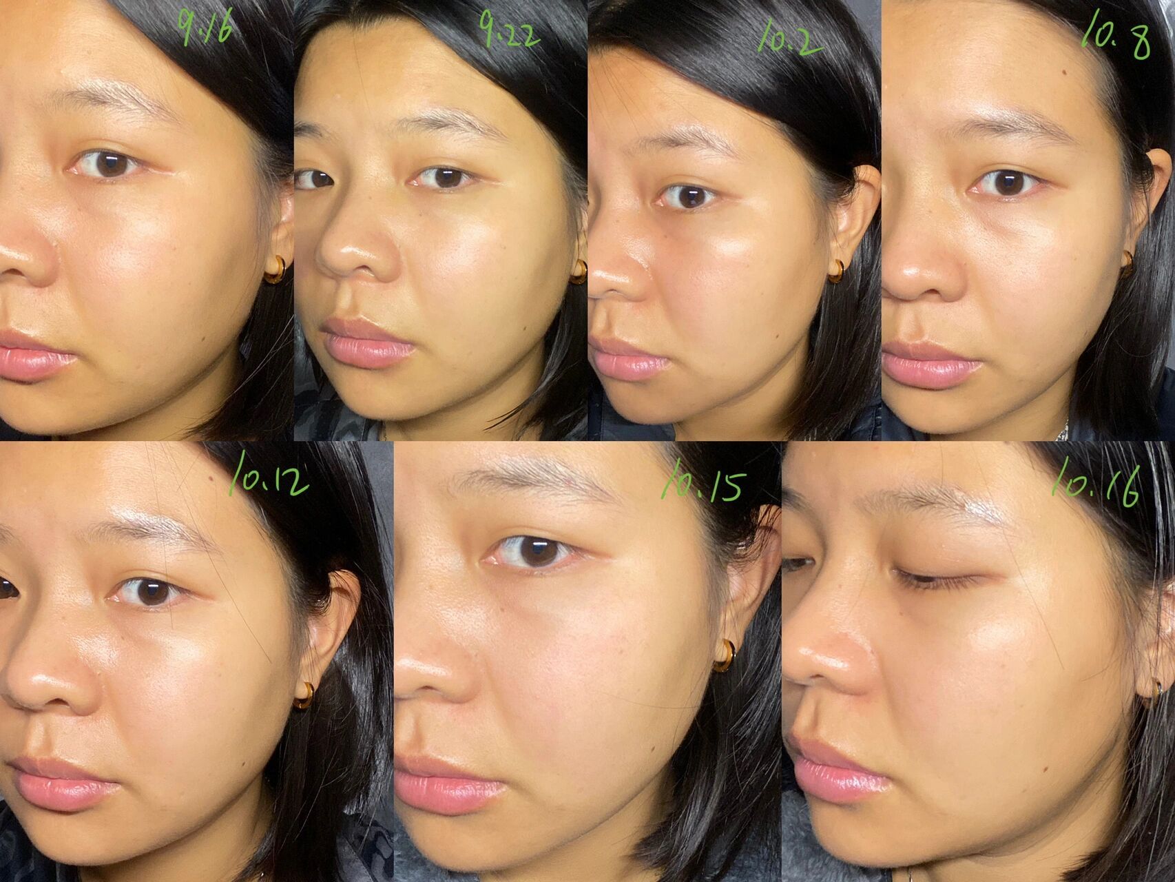 纯纯黑黄皮看效果(对比明显也可能是我黑) 但是真的有变白!