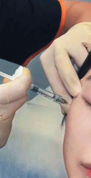 精灵耳注射常用玻尿酸填充,可以打在耳垂或耳后