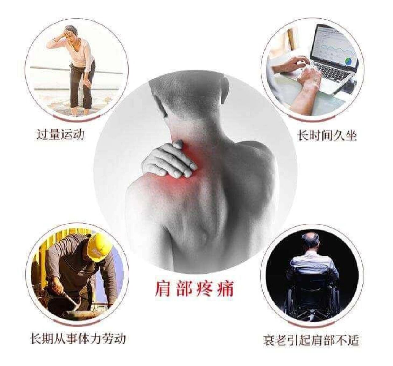 肩周炎表现症状有哪些?