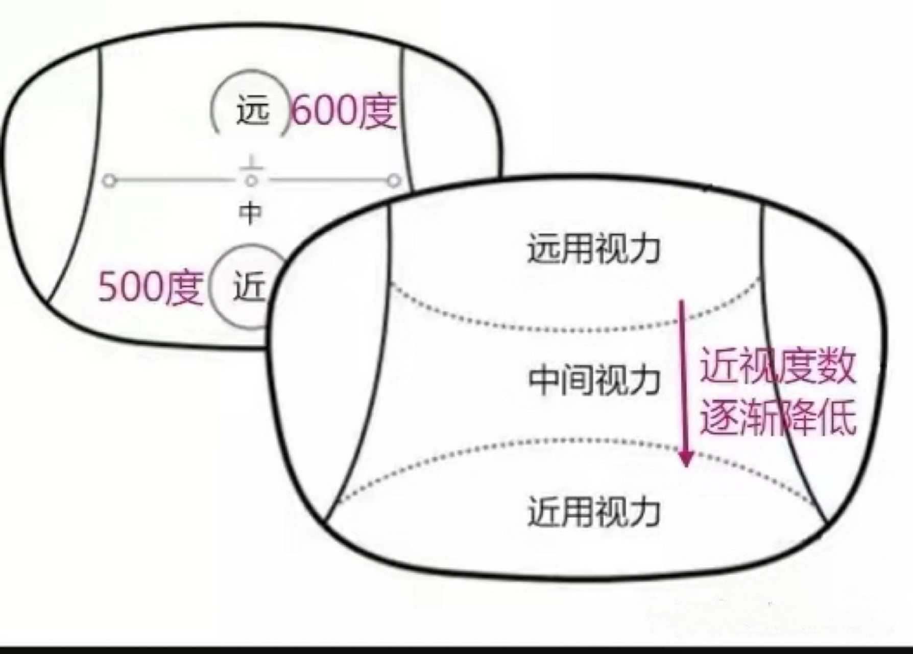 抗疲劳镜片又叫数码型镜片 抗疲劳镜片的原理是通过降低看近的度数的
