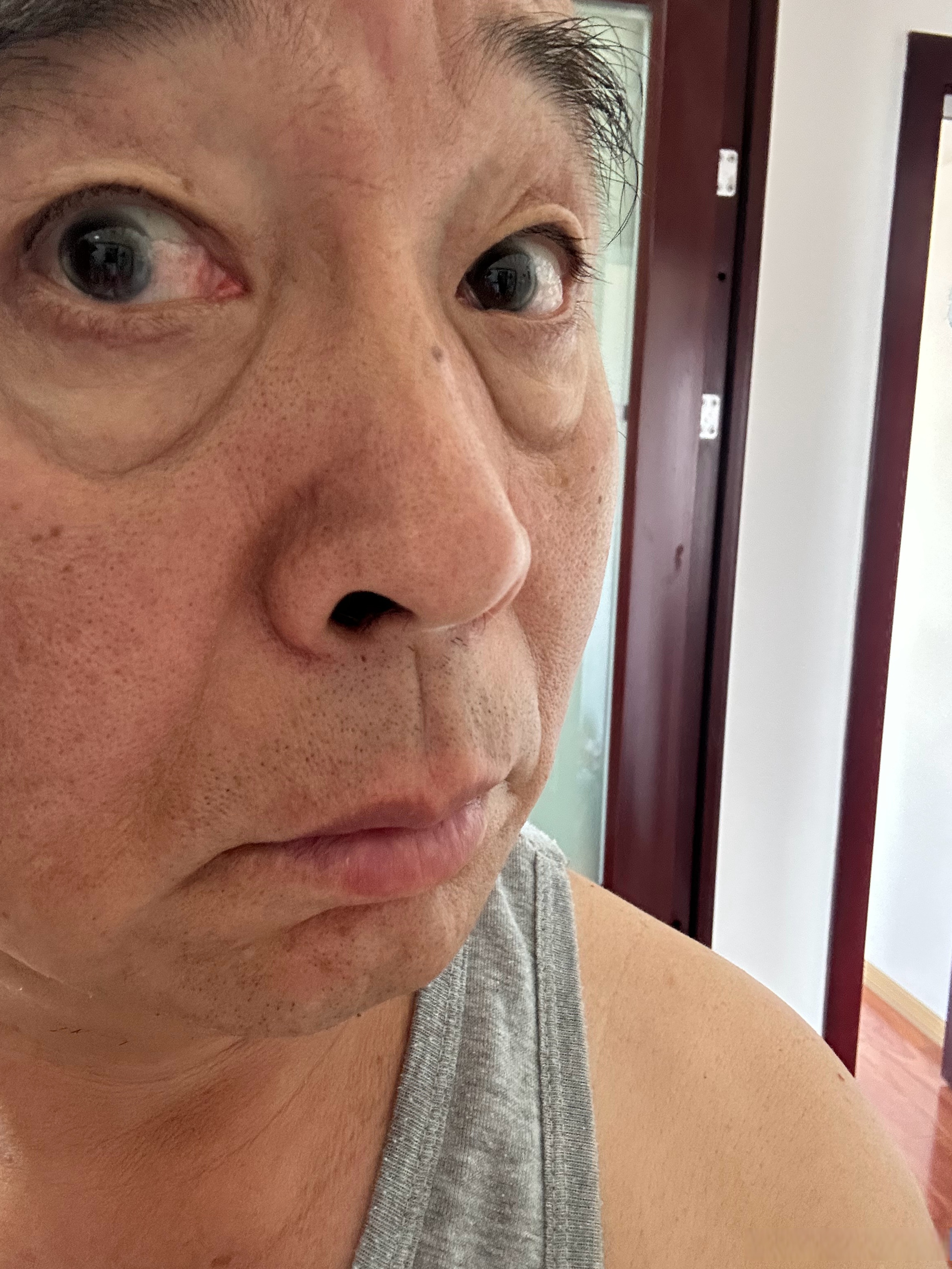 右眼内眼角的褶皱小了,并且褶皱以前是从上到下贯通
