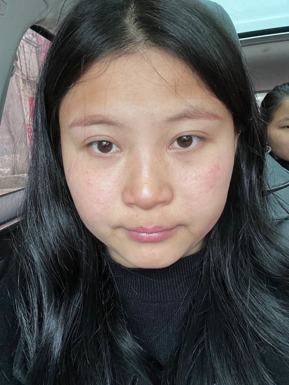 为什么鼻子嘴巴一圈好黄啊 是得病拉?