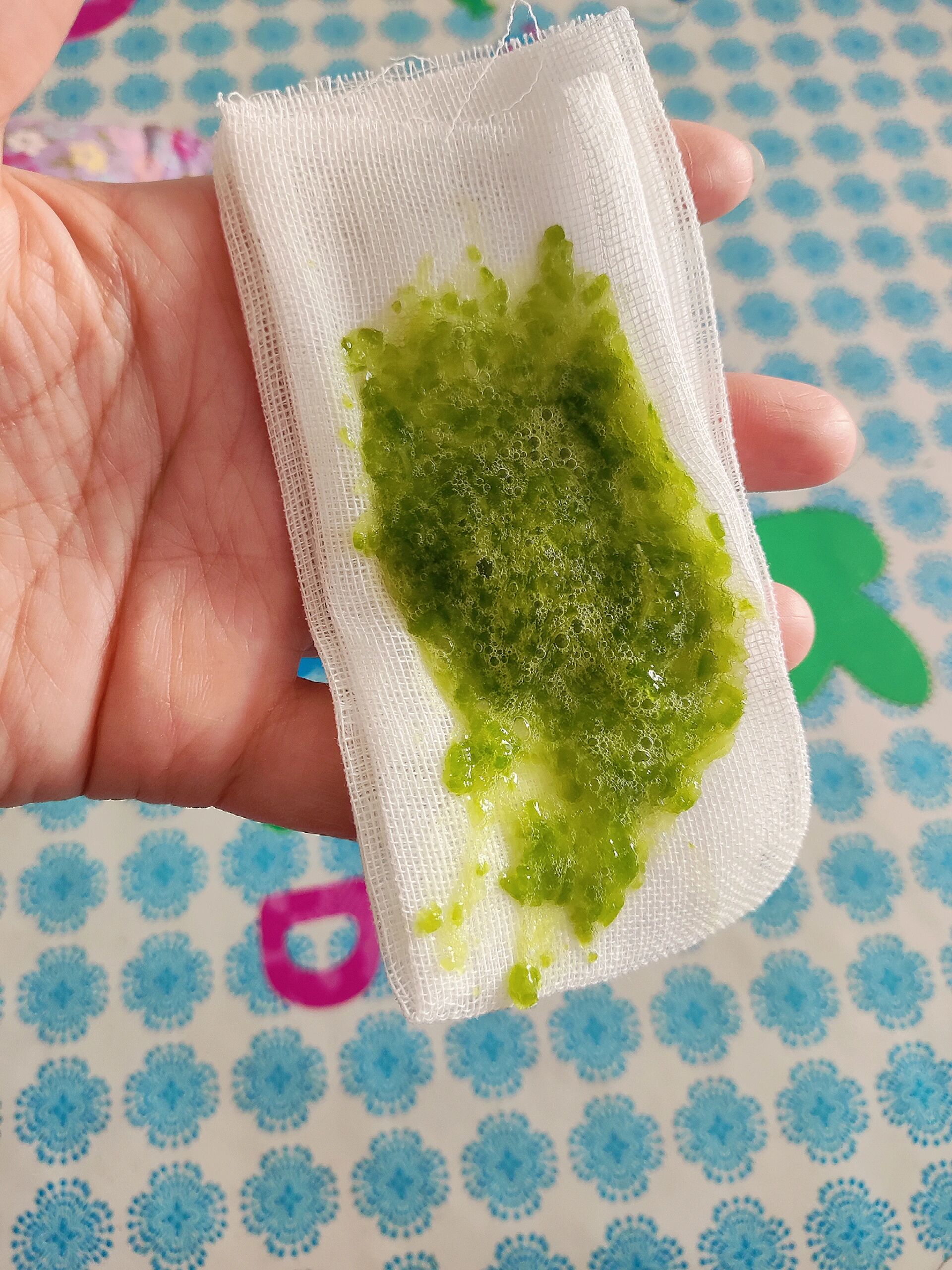 治疗儿童腮腺炎亲测有效 朵姐腮腺炎三天吃药不消肿,仙人掌去刺去皮