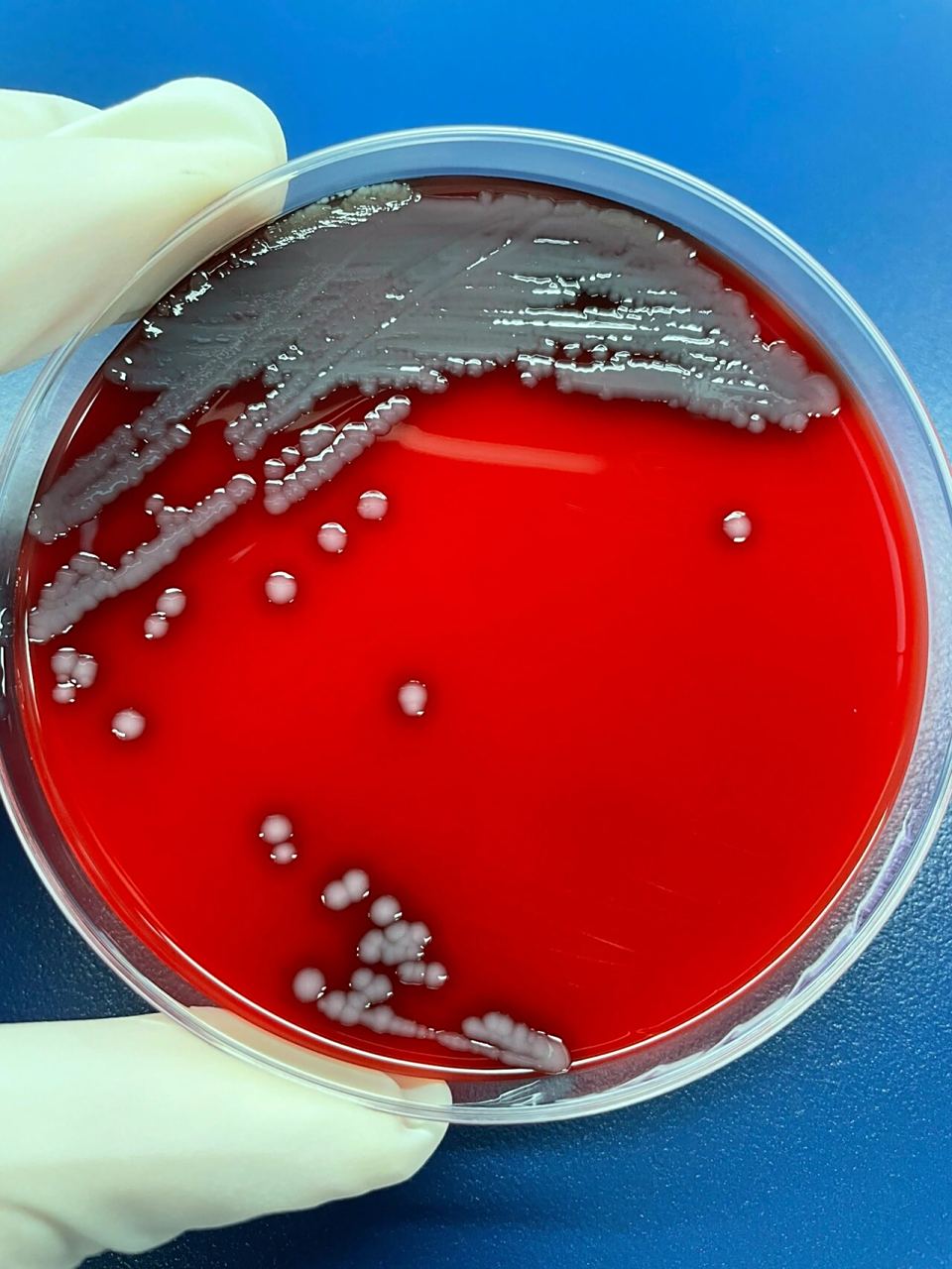 图1:tcbs平板上菌落形态 图23:血平板上菌落形态
