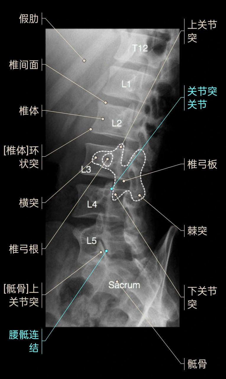 骶尾椎侧位图片