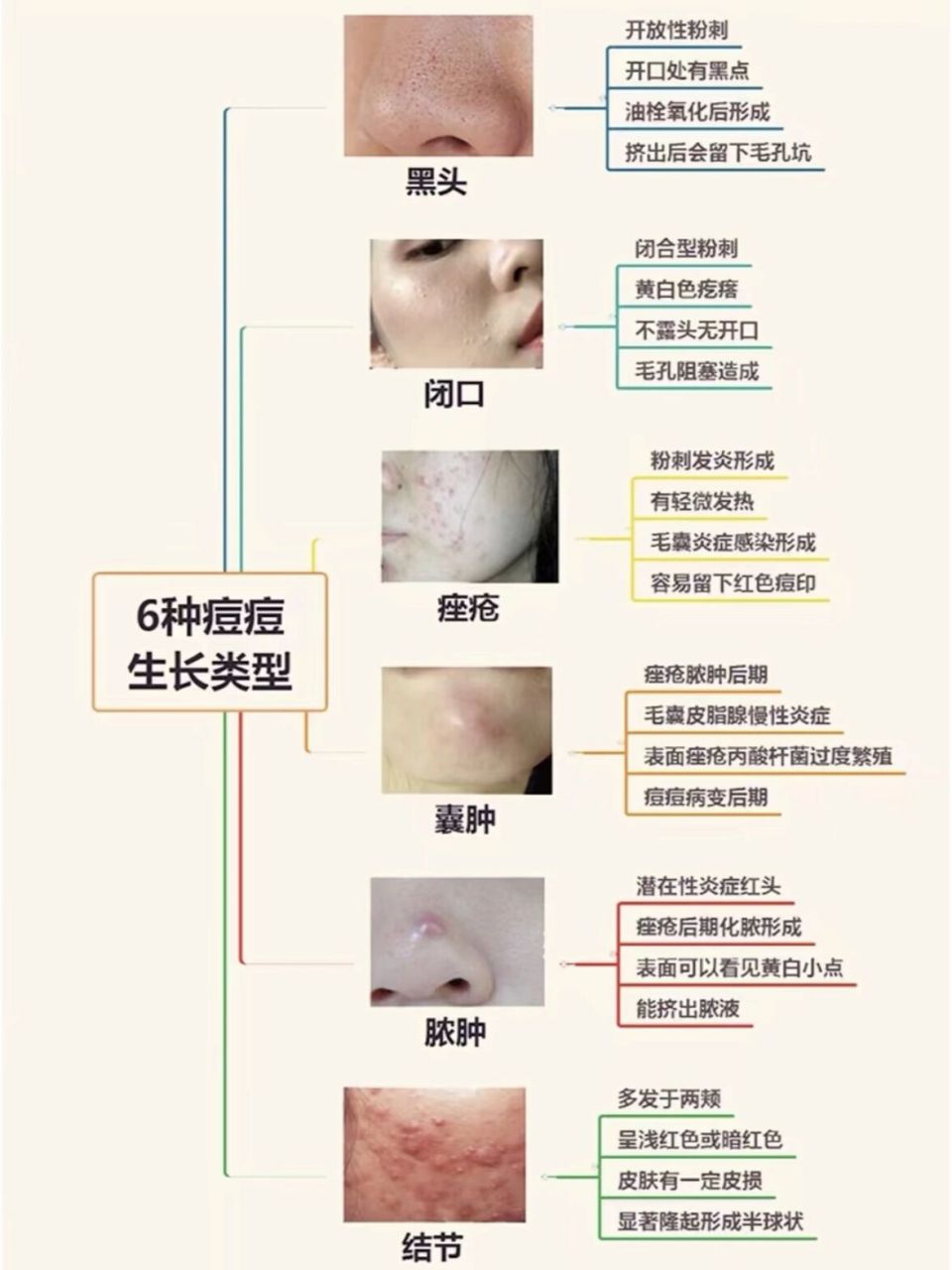 粉刺和痘痘怎么区分图片