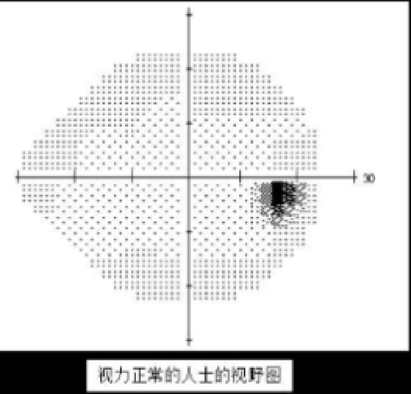 视野图示意图图片