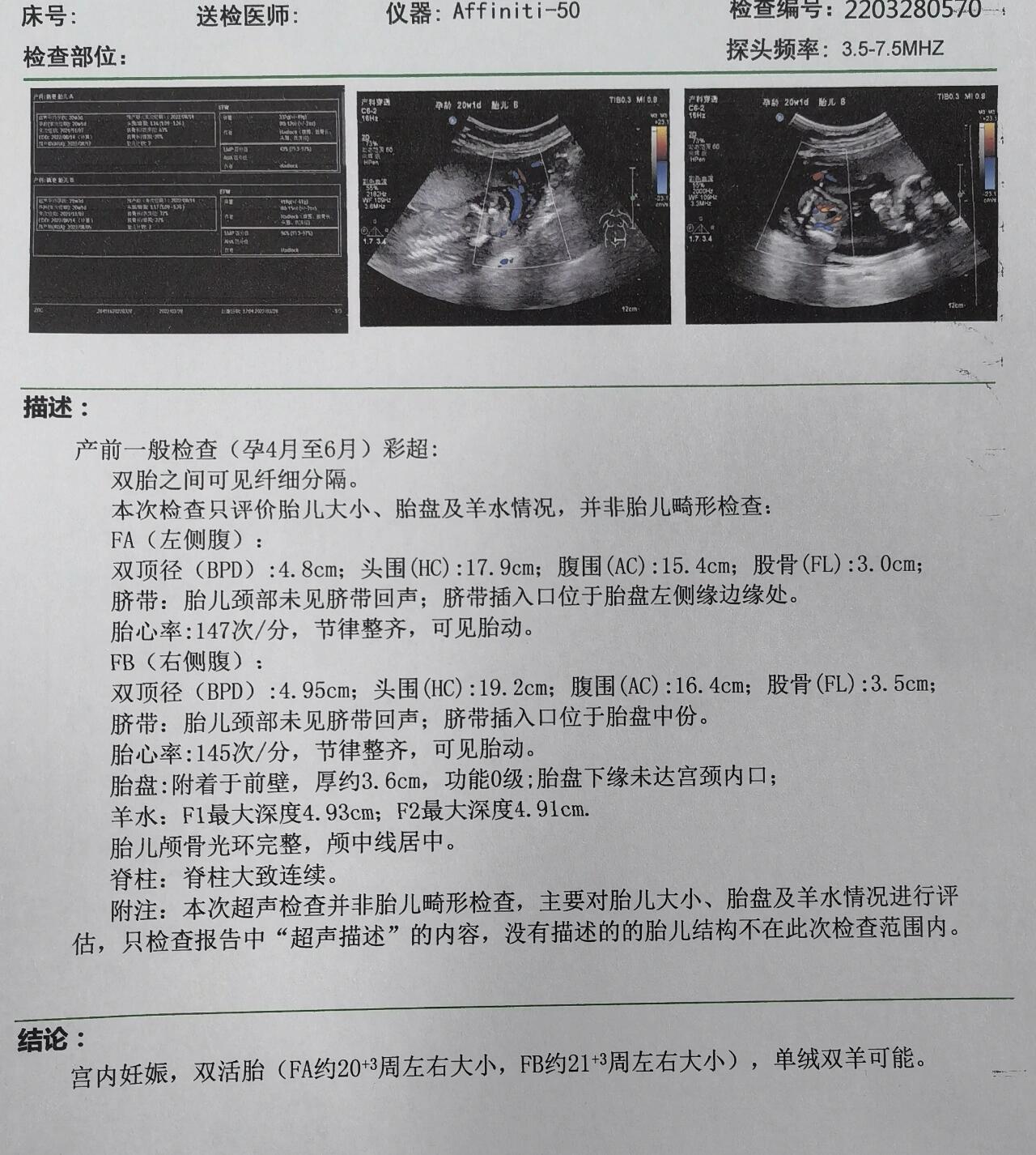 双子宫超声报告模板图片