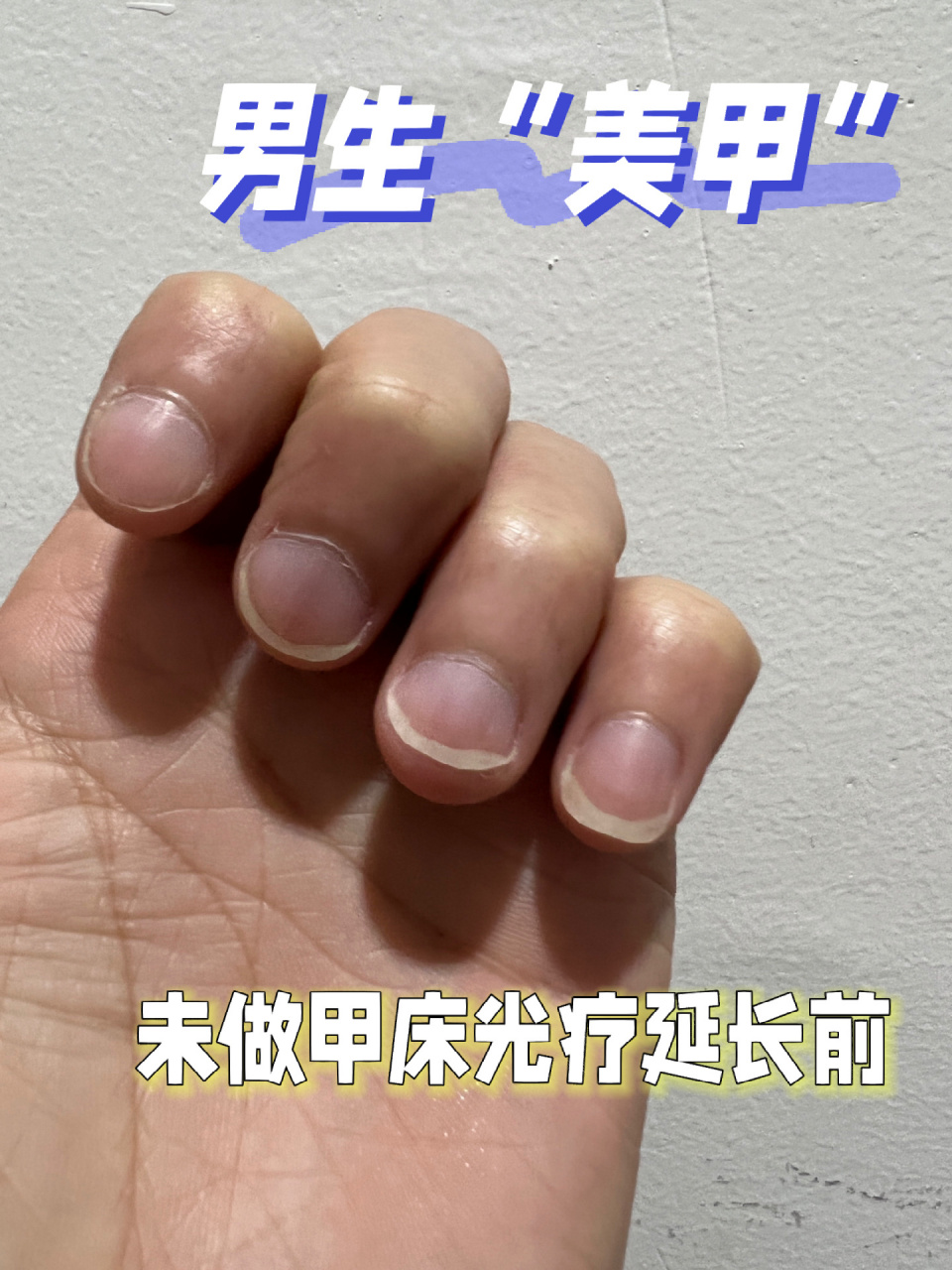 这篇只是希望能够帮助到正在苦恼指甲丑的男生们 比较啰嗦 写的有点长