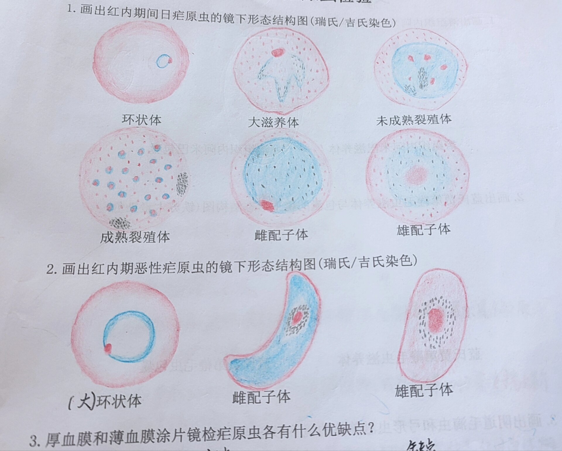 疟原虫检验实验报告 间日疟 恶性疟 手绘 寄生虫实验报告