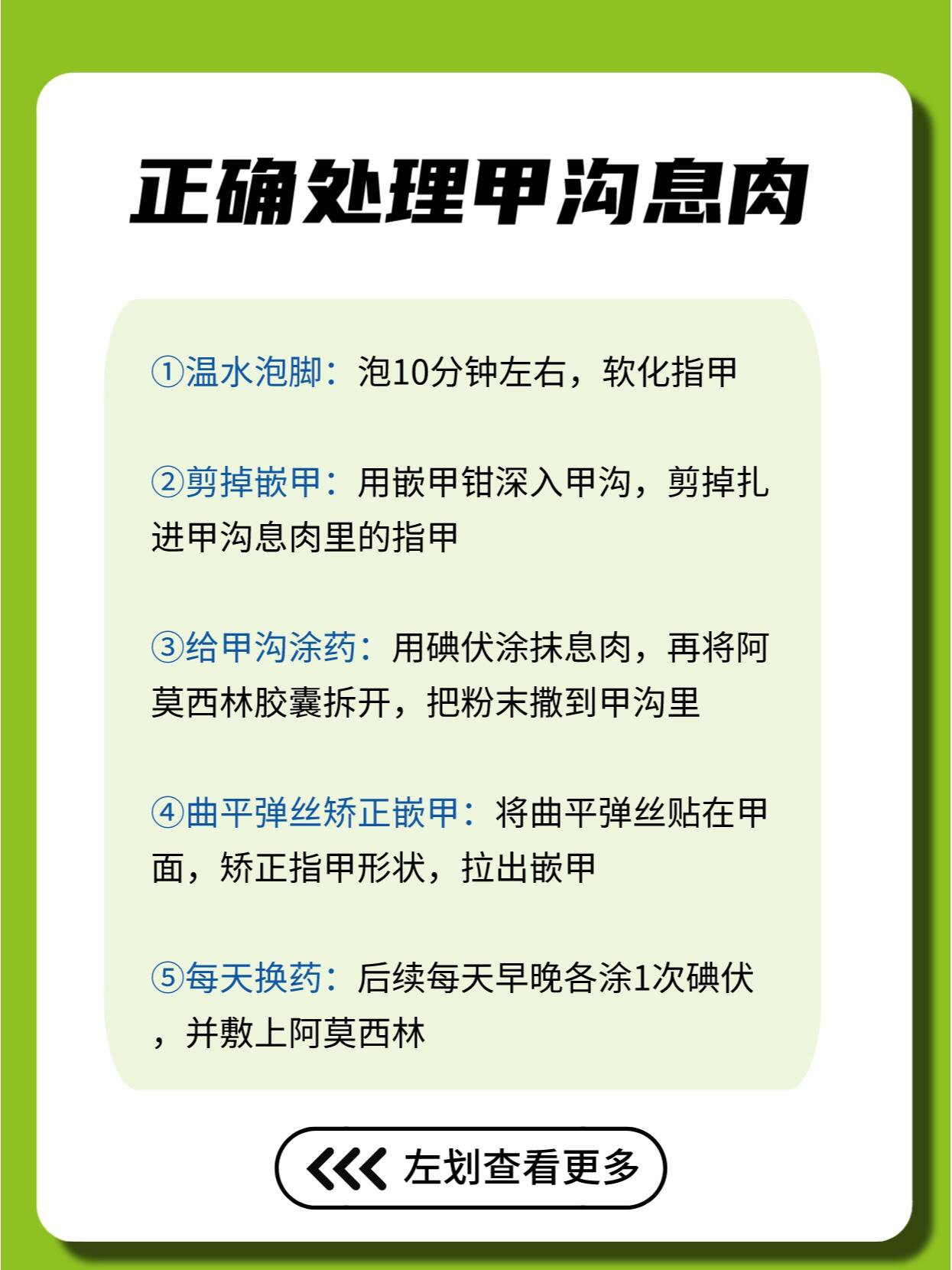 94 你需要准备这些工具95  嵌甲钳