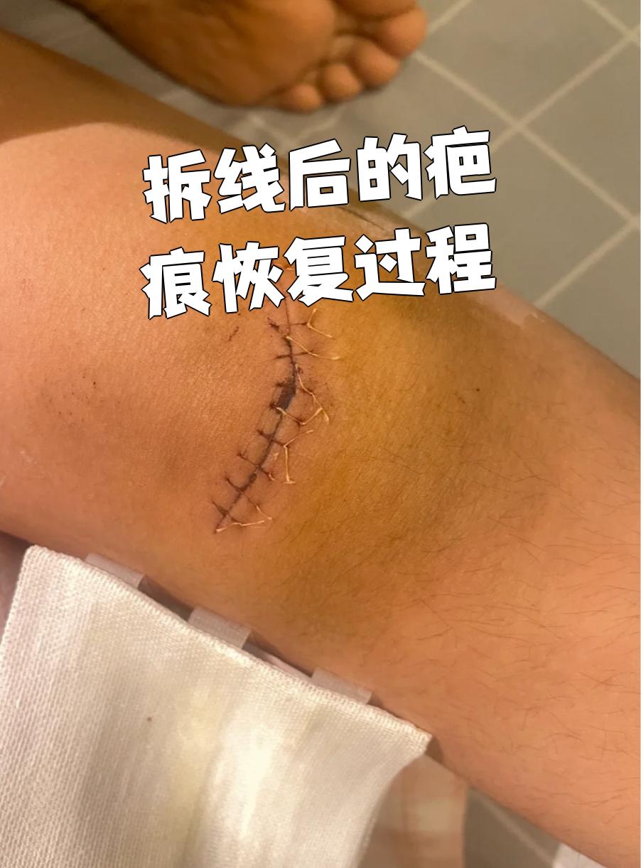 整个过程需要好几个月时间