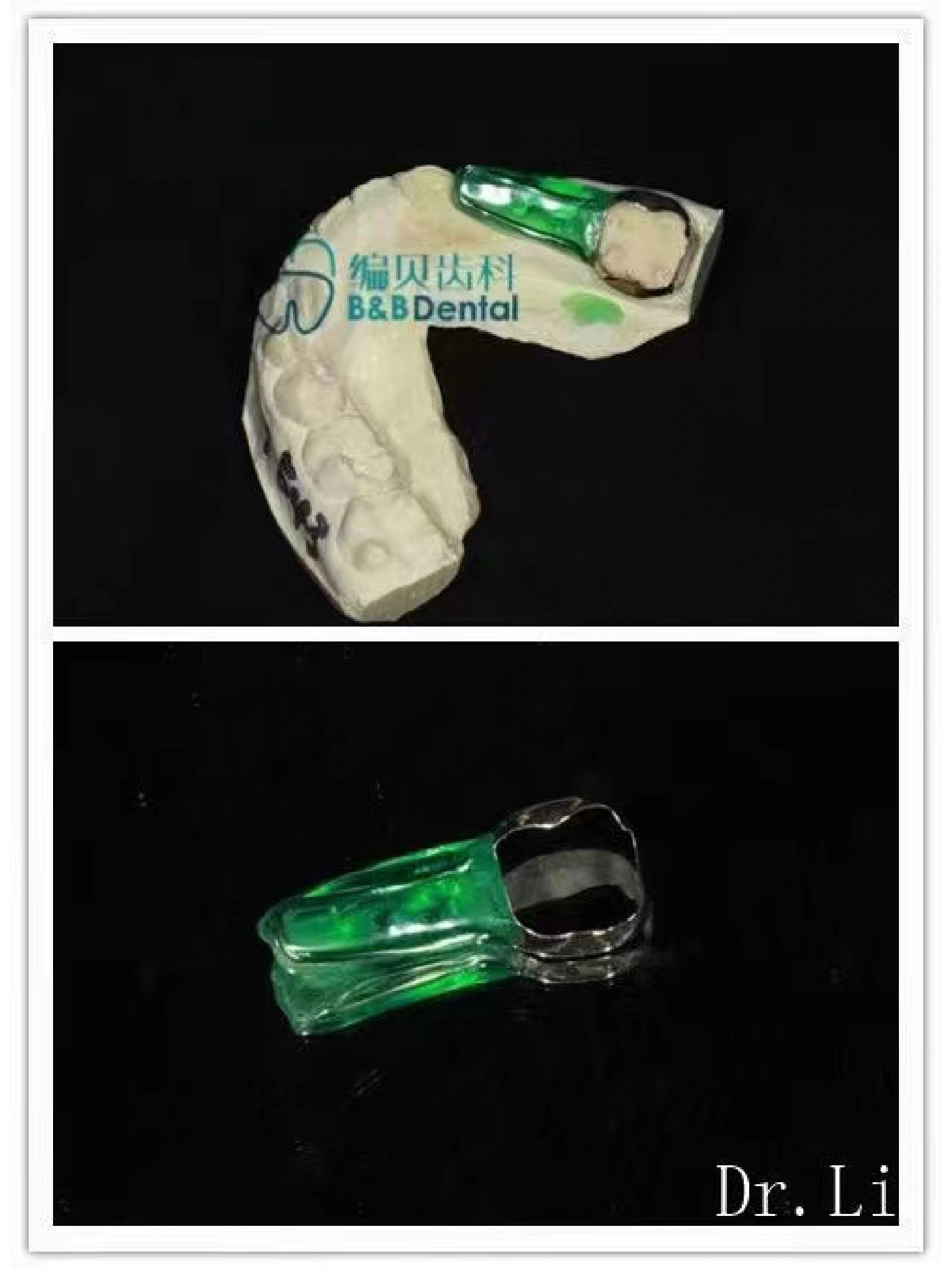 它不是用来做儿童牙齿矫正的哦,主要用来防止下面的牙齿过早萌发而做