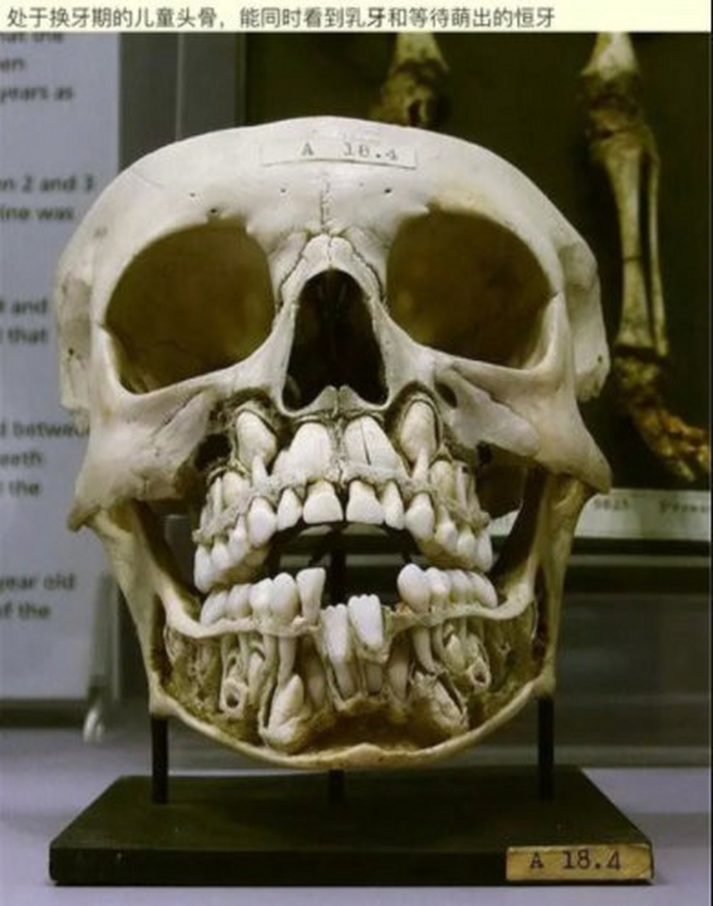 换牙期小朋友的牙片可以清楚看到有四排牙齿  (还有两颗是长在眼睛