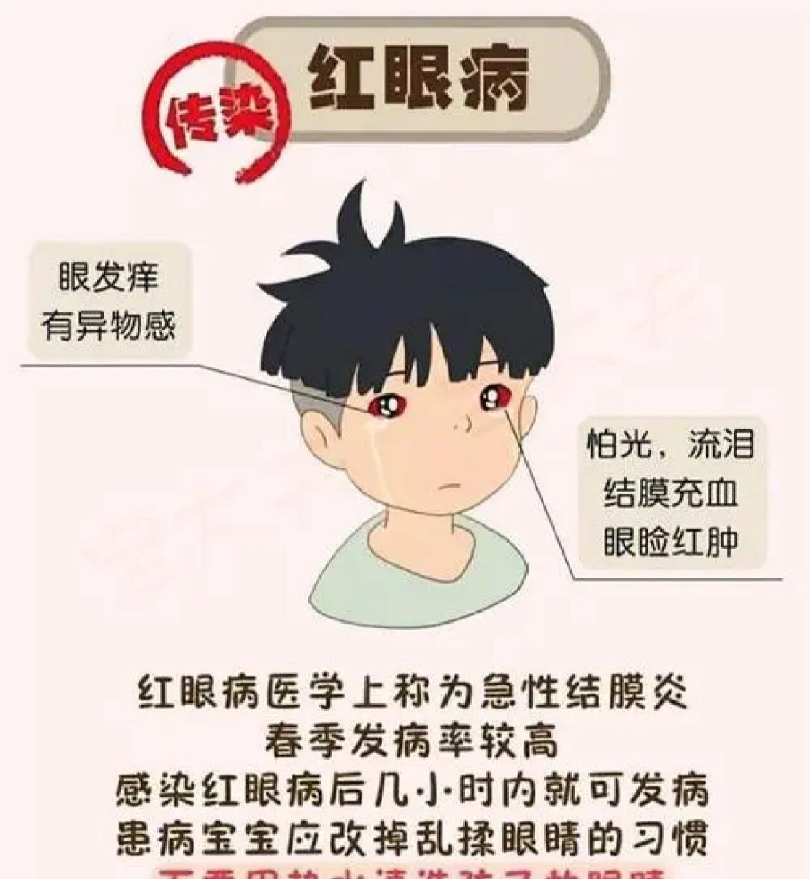 "红眼病"起病急,发展快.