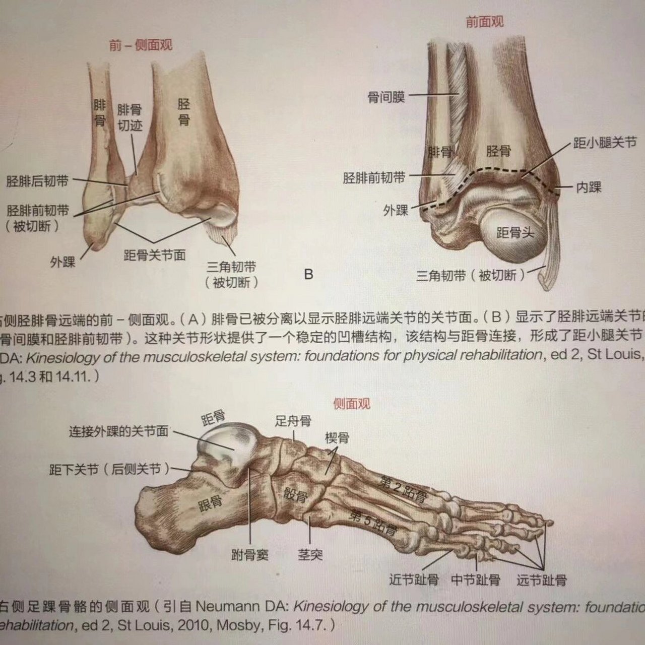 足关节名称图片