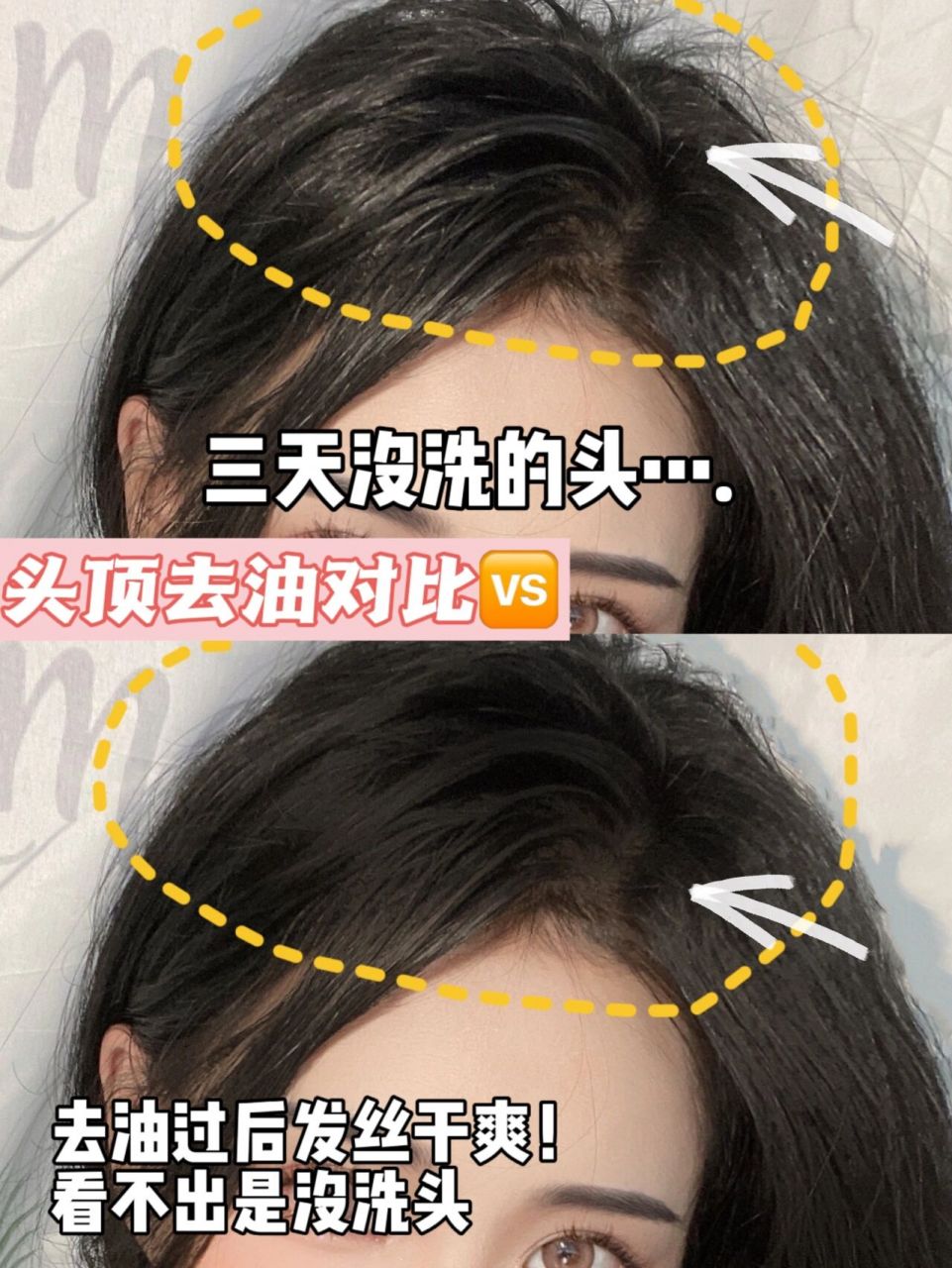 99头发去油p图教程|不洗头自拍的秘籍 我的头发一直被大家问了很久