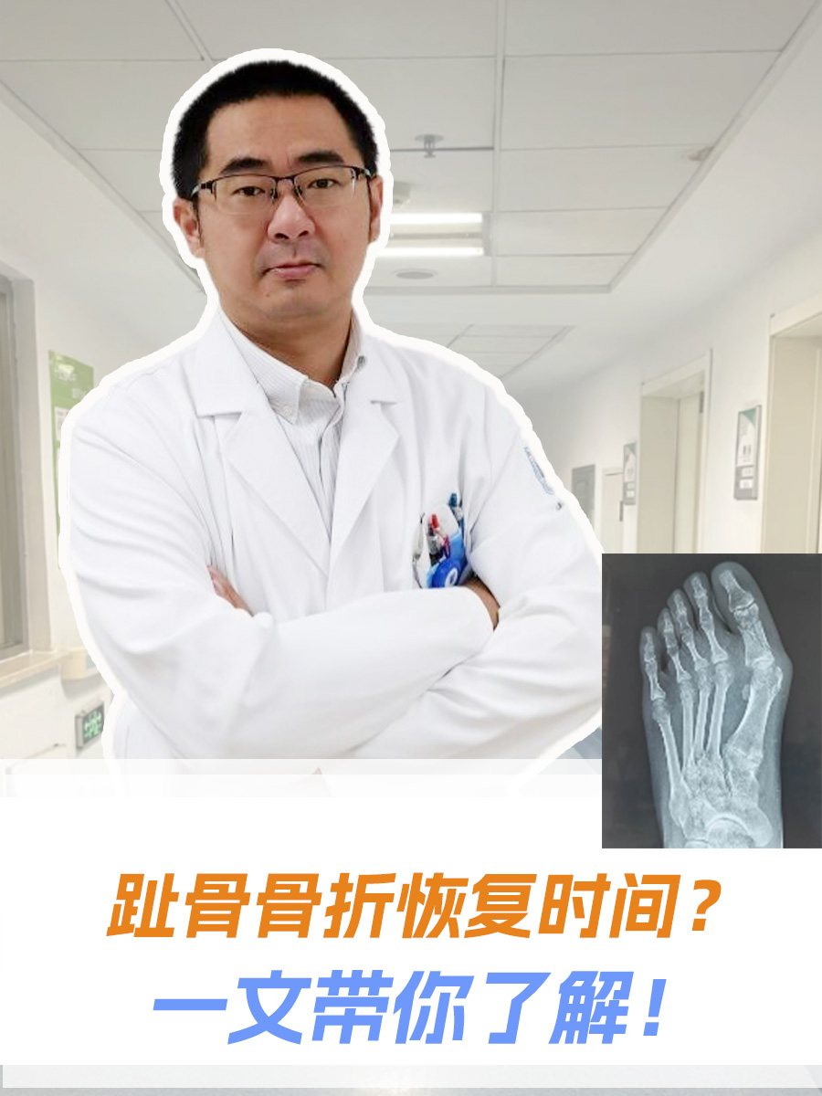 趾骨骨折,作为日常生活中较为常见的一种骨折类型,虽然不算是严重的