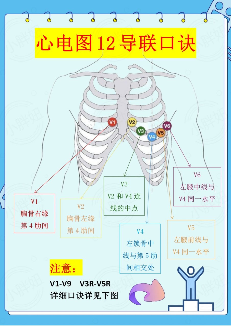 心电图导联颜色位置图片