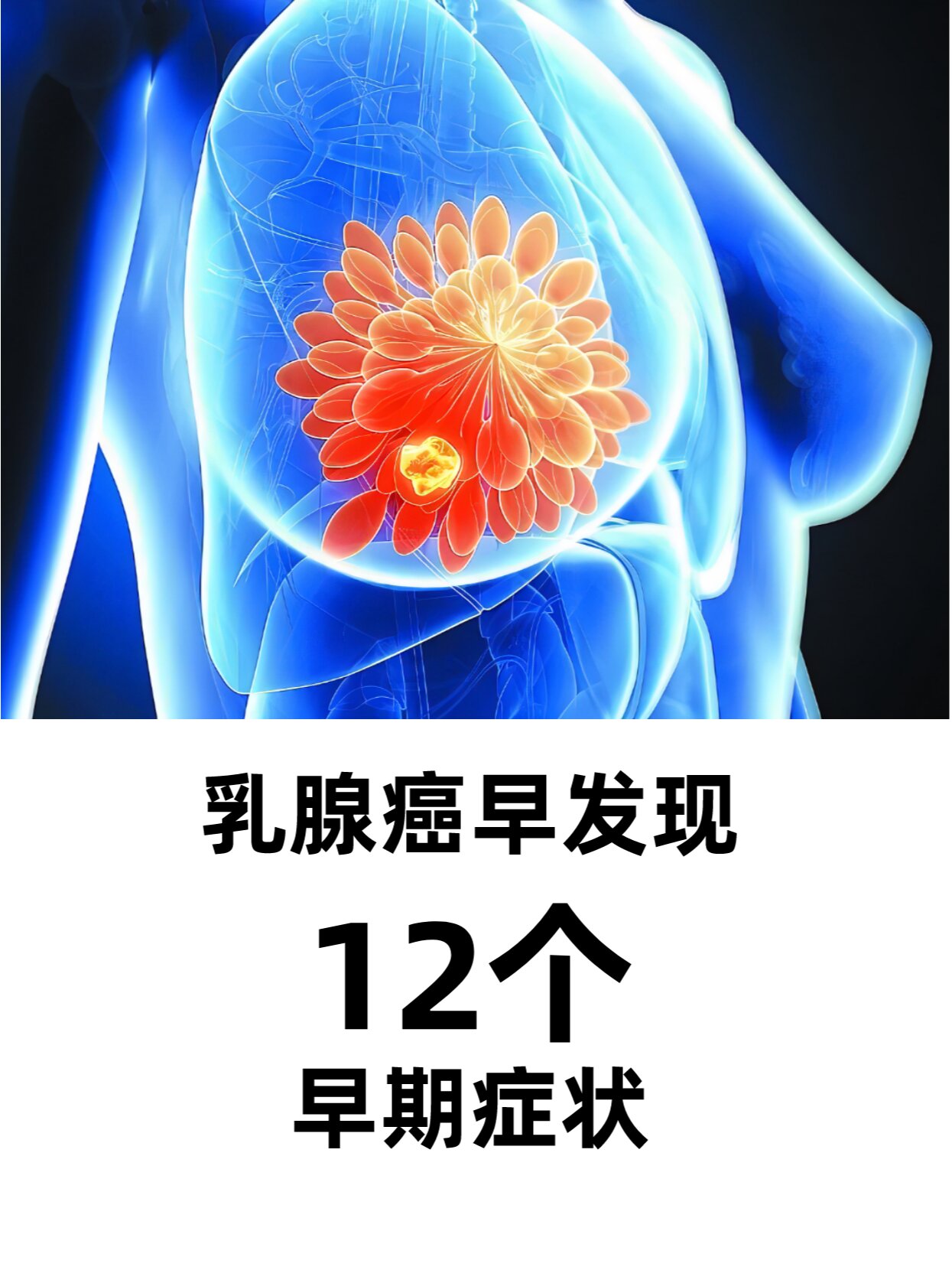 有1项都要去检查 之前的笔记《如何早期发现乳腺癌》有图片版