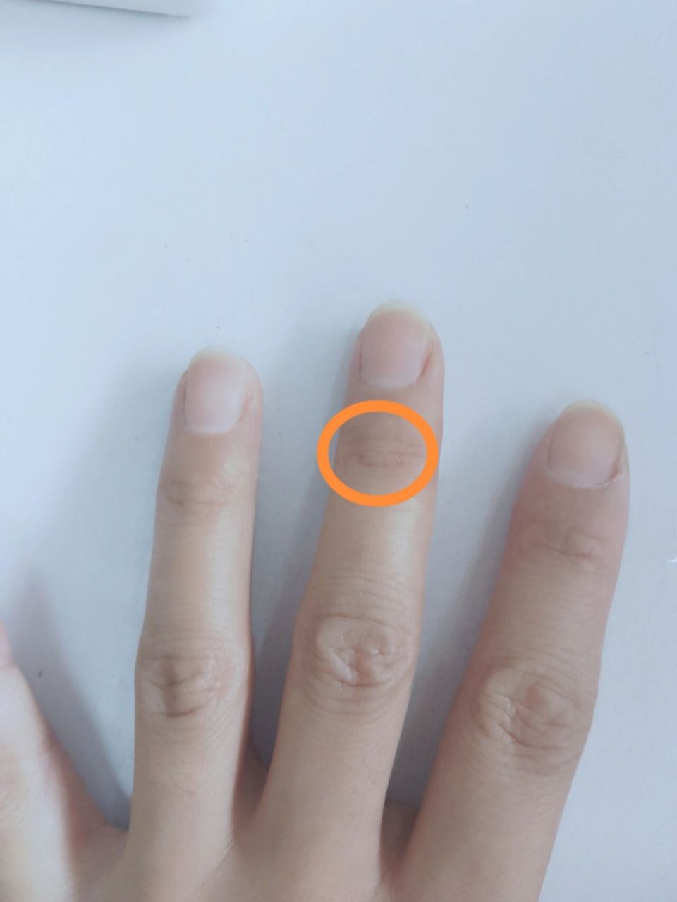 两个手的中指关节处疼 去年的时候,两个手的食指中指无名指,等于加