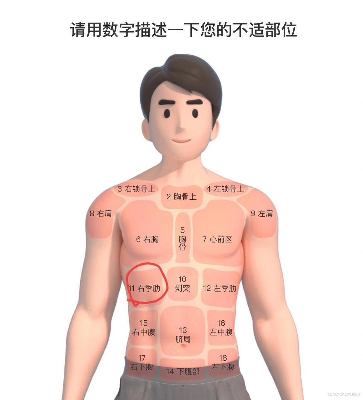 右侧肋下疼,筋膜炎吗 右侧肋下疼,吸气疼,咳嗽到喷嚏疼的简直要命,是