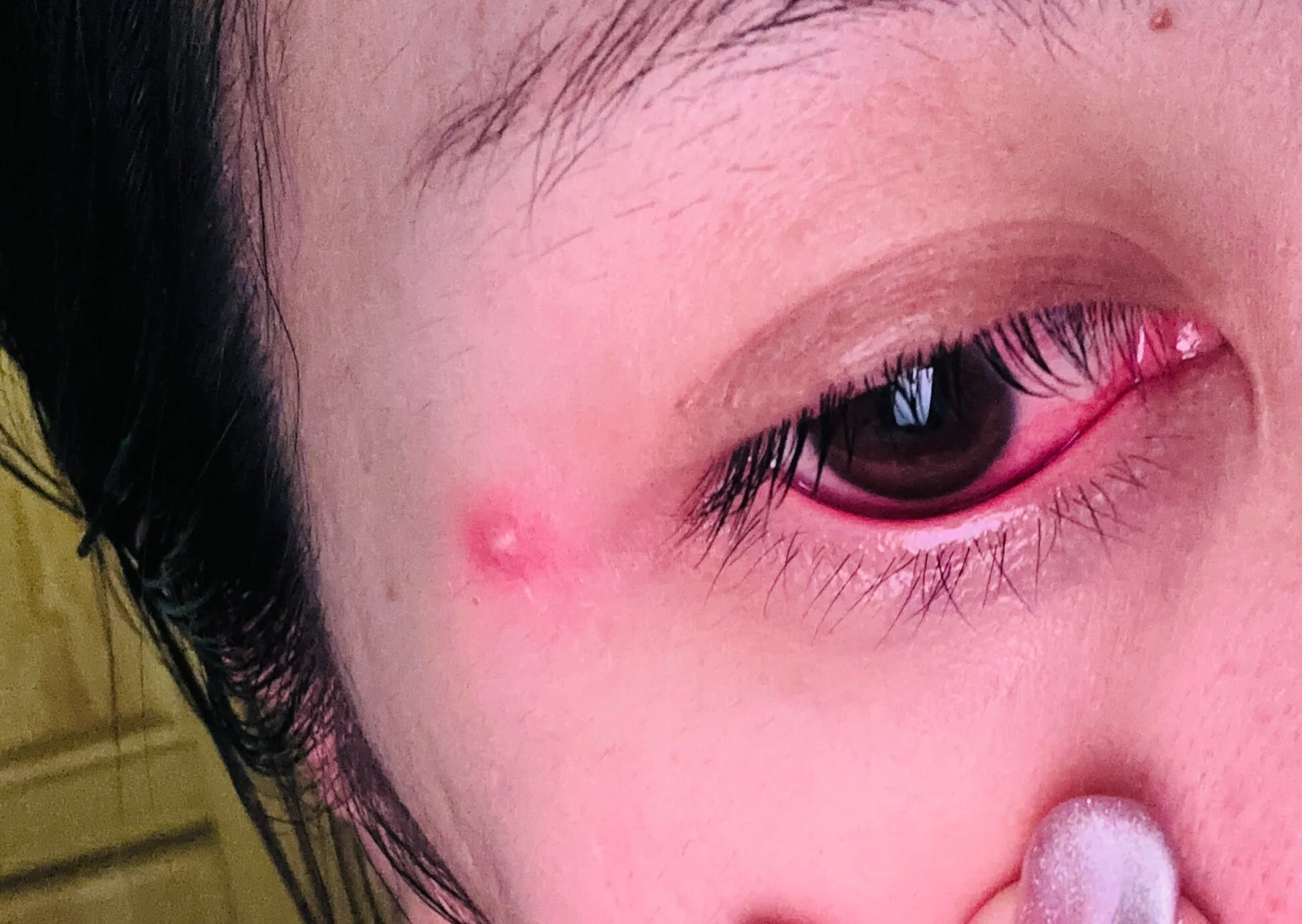 从这双眼睛里你看到了什么 我这个烂眼睛,我也真是无语了95