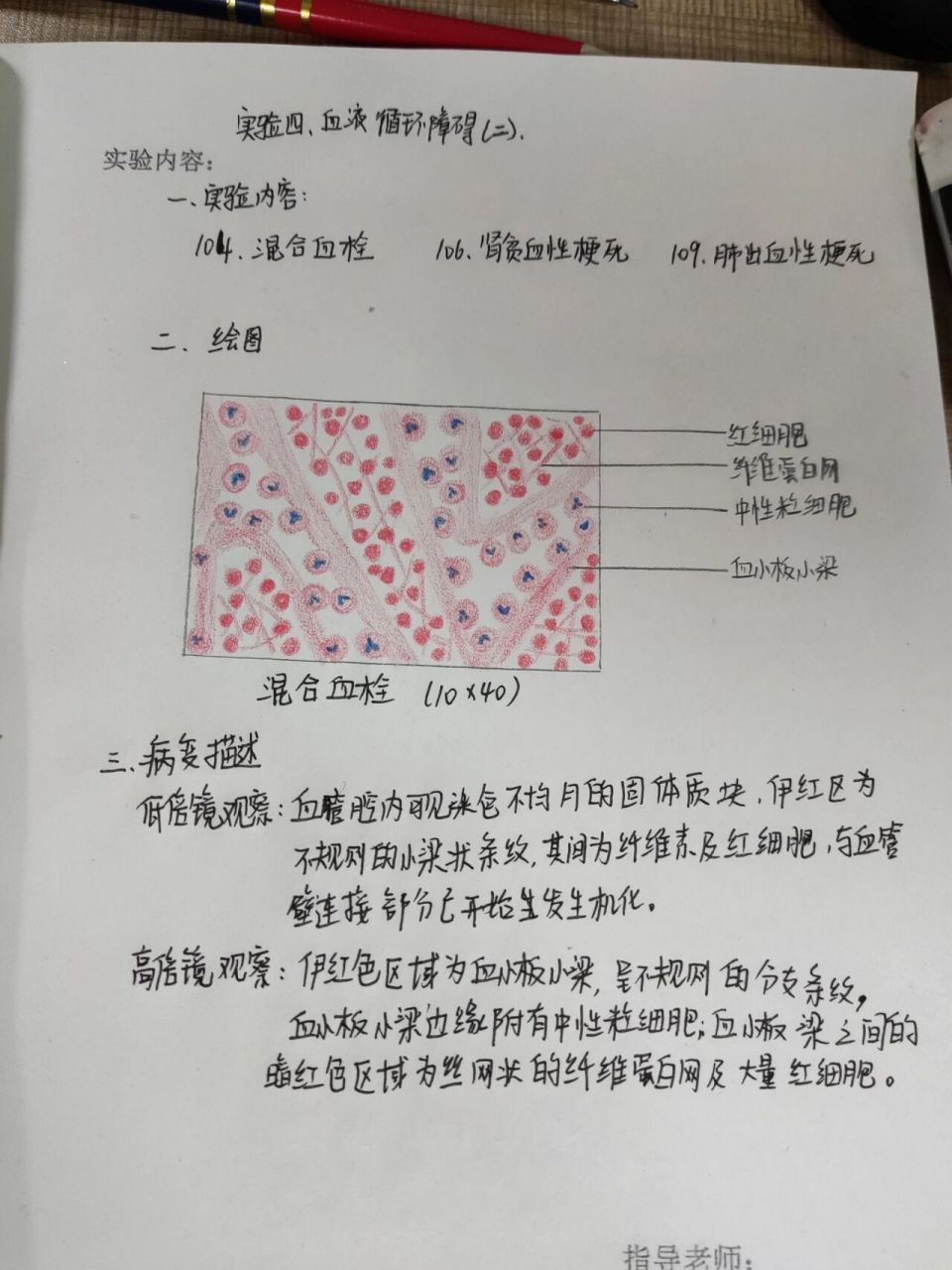 病理学 混合血栓红蓝铅笔绘图