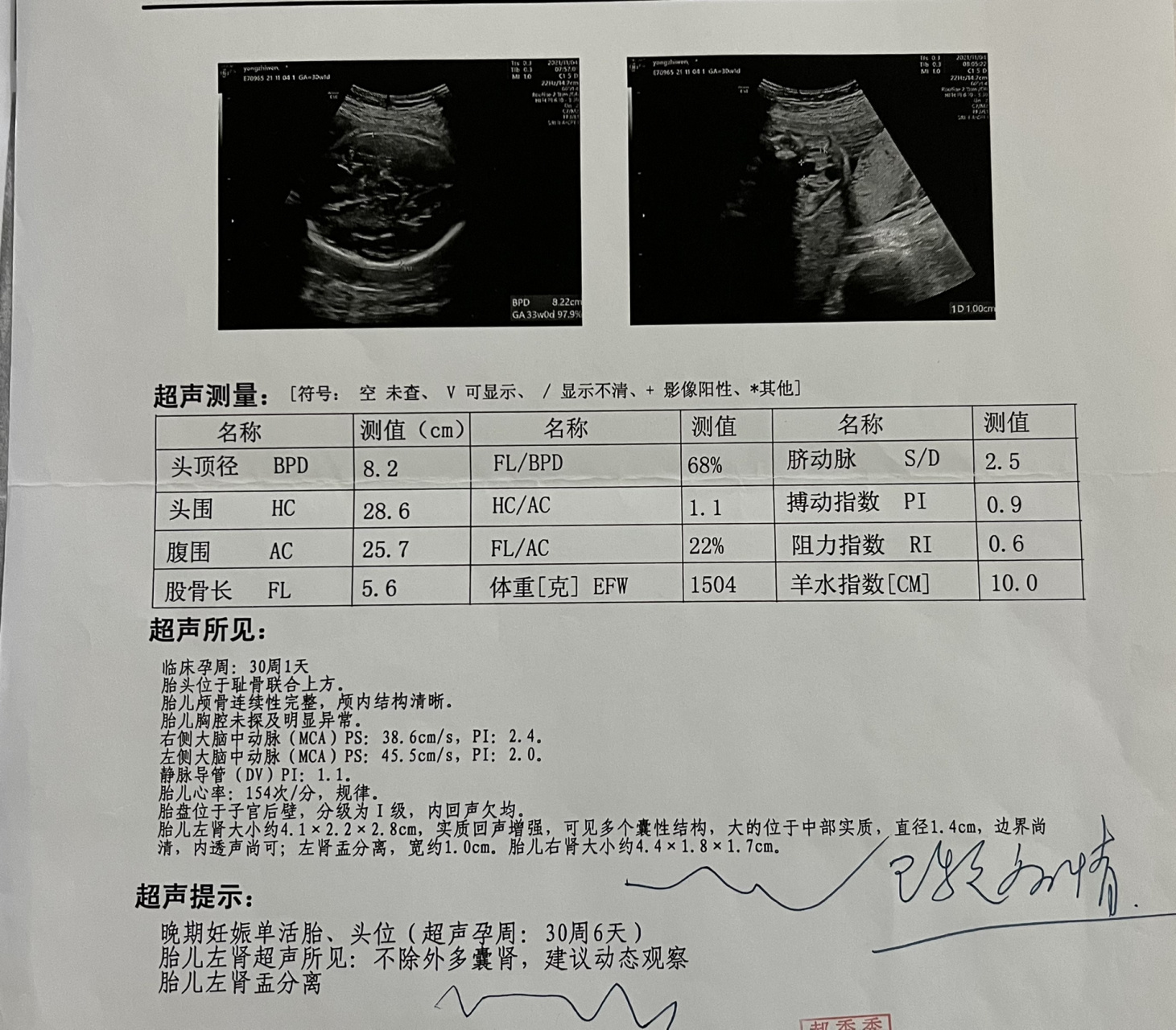 先区分下多囊肾,多囊性发育不良肾,肾囊肿.