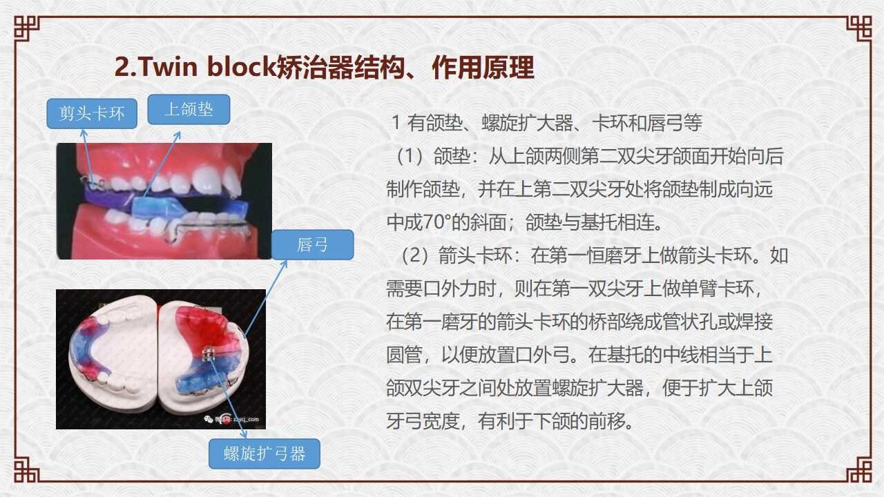 tb矫治器的结构,作用原理