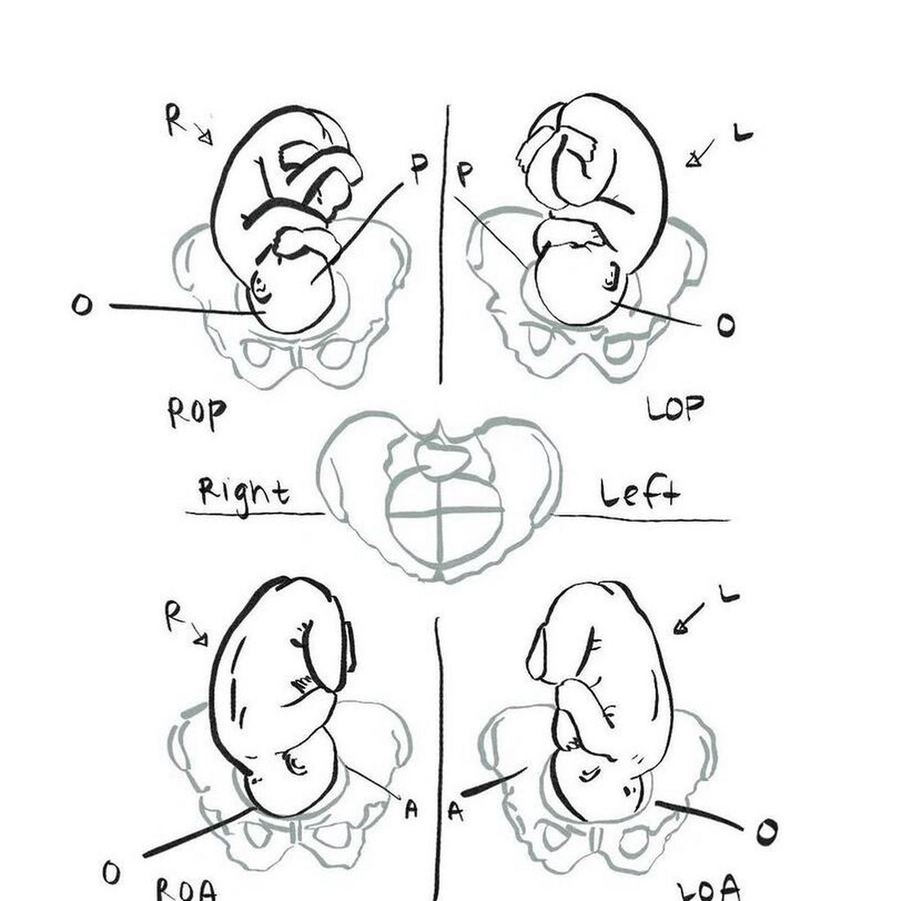 医学英语胎位fetal position &presentation l/r 母亲的左右 o