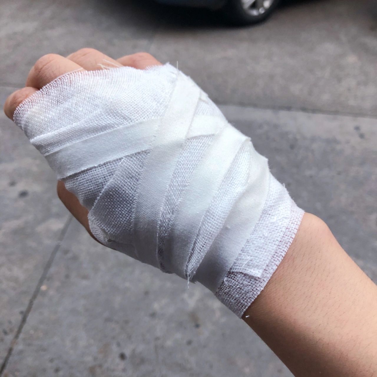 受伤搞怪文案分享|朋友圈文案分享 1.